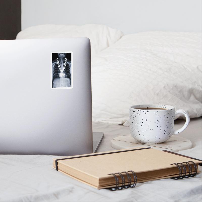 Xray of a hip-hopper